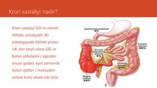 Kron xəstəliyi nədir?
Kron xəstəliyi GİS-in xroniki
iltihabı xəstəliyidir. Bu
patologiyada iltihabi proses
UK-dən fərqli olara GİS-in
bütün şöbələrini ( ağızdan
anusa qədər), eyni zamanda
bütün qatları ( mukozdan
seroza kimi) əhatə edə bilər.
 