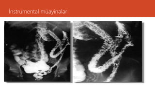 İnstrumental müayinələr
 