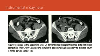 İnstrumental müayinələr
 