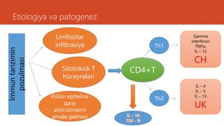 Etiologiya və patogenez
İmmuntənzimin
pozulması
Limfositar
infiltrasiya
Sitotoksik T
hüceyrələri
Kolon epitelinə
qarşı
anticisimlərin
əmələ gəlməsi
CD4+T
Th1
Th2
Qamma
interferon
TNFα,
İL – 12
CH
İL – 4
İL – 5
İL – 13
UK
 