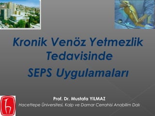 Kronik Venöz Yetmezlik
Tedavisinde
SEPS Uygulamaları
Prof. Dr. Mustafa YILMAZ
Hacettepe Üniversitesi, Kalp ve Damar Cerrahisi Anabilim Dalı
 