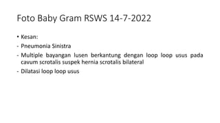Foto Baby Gram RSWS 14-7-2022
• Kesan:
- Pneumonia Sinistra
- Multiple bayangan lusen berkantung dengan loop loop usus pada
cavum scrotalis suspek hernia scrotalis bilateral
- Dilatasi loop loop usus
 
