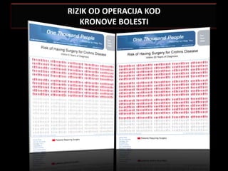 RIZIK OD OPERACIJA KOD
   KRONOVE BOLESTI
 