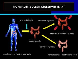 NORMALNI I BOLESNI DIGESTIVNI TRAKT



                      crevne bakterije   poremedaj regulacije




                                                        hronična nekontrolisana upala


                                umerena upala


                                            normalna regulacija


normalno crevo – kontrolisana upala                  normalno crevo – kontrolisana upala
 