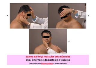 Exame da força muscular dos músculos
mm. esternocleidomastóide e trapézio
(inervados pelo XI°par craniano – nervo acessório).
 