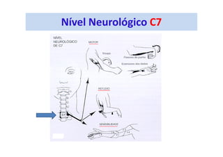 Nível Neurológico C7
 