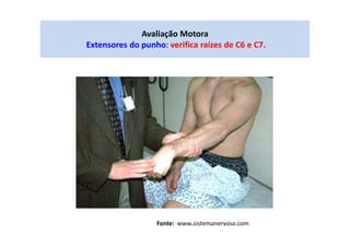 Avaliação Motora
Extensores do punho: verifica raízes de C6 e C7.
Fonte: www.sistemanervoso.com
 