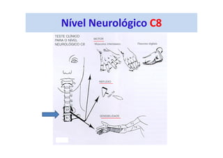 Nível Neurológico C8
 