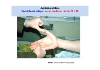 Avaliação Motora
Oposição do polegar: nervo mediano, raíz de C8 e T1.
Fonte: www.sistemanervoso.com
 