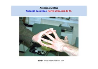 Avaliação Motora
Abdução dos dedos: nervo ulnar, raíz de T1.
Fonte: www.sistemanervoso.com
 