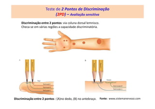 Teste de 2 Pontos de Discriminação
(2PD) – Avaliação sensitiva
Discriminação entre 2 pontos: via coluna dorsal lemnisco.
Checa-se em várias regiões a capacidade discriminatória.
Discriminação entre 2 pontos : (A)no dedo, (B) no antebraço. Fonte: www.sistemanervoso.com
 