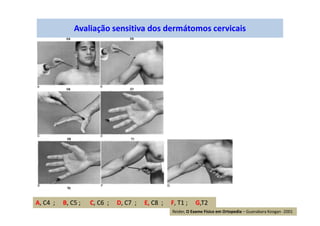 Avaliação sensitiva dos dermátomos cervicais
A, C4 ; B, C5 ; C, C6 ; D, C7 ; E, C8 ; F, T1 ; G,T2
Reider, O Exame Físico em Ortopedia – Guanabara Koogan -2001
 