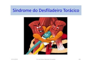 07/12/2015 Dr. José Heitor Machado Fernandes 204
Síndrome do Desfiladeiro Torácico
 