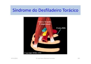 07/12/2015 Dr. José Heitor Machado Fernandes 205
Síndrome do Desfiladeiro Torácico
 
