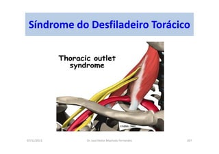 07/12/2015 Dr. José Heitor Machado Fernandes 207
Síndrome do Desfiladeiro Torácico
 