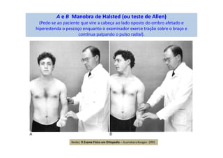 A e B Manobra de Halsted (ou teste de Allen)
(Pede-se ao paciente que vire a cabeça ao lado oposto do ombro afetado e
hiperestenda o pescoço enquanto o examinador exerce tração sobre o braço e
continua palpando o pulso radial).
Reider, O Exame Físico em Ortopedia – Guanabara Koogan -2001
 