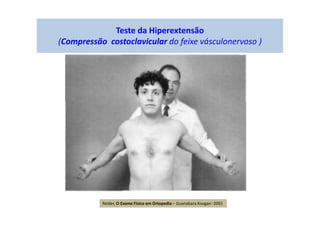 Teste da Hiperextensão
(Compressão costoclavicular do feixe vásculonervoso )
Reider, O Exame Físico em Ortopedia – Guanabara Koogan -2001
 