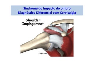 Síndrome do Impacto do ombro
Diagnóstico Diferencial com Cervicalgia
 