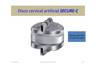 07/12/2015 Dr. José Heitor M. Fernandes 301
Disco cervical artificial SECURE-C
Liberado pelo FDA
em julho de 2006
 