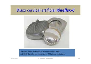 07/12/2015 Dr. José Heitor M. Fernandes 302
Disco cervical artificial Kineflex-C
Começou a ser usado nos USA em Janeiro de 2005.
Até 2009 deverão ser implantados 400 discos deste tipo.
 