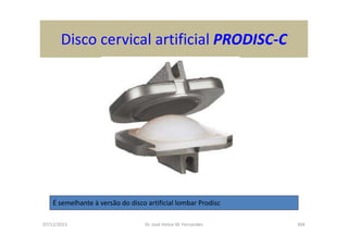 07/12/2015 Dr. José Heitor M. Fernandes 304
Disco cervical artificial PRODISC-C
É semelhante à versão do disco artificial lombar Prodisc
 