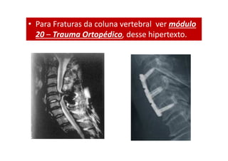 • Para Fraturas da coluna vertebral ver módulo
20 – Trauma Ortopédico, desse hipertexto.
 