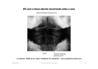 figura
07/12/2015 Dr. José Heitor M. Fernandes 39
RX com a boca aberta mostrando atlas e axis
 