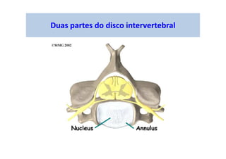 Duas partes do disco intervertebral
 