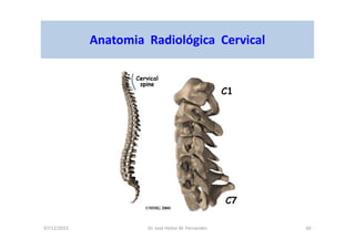 07/12/2015 Dr. José Heitor M. Fernandes 60
Anatomia Radiológica Cervical
 