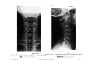 07/12/2015 Dr. José Heitor M. Fernandes 65
AP Lateral
 