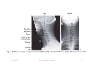 07/12/2015 Dr. José Heitor M. Fernandes 66
 
