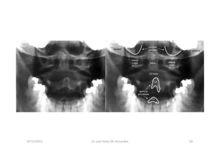 07/12/2015 Dr. José Heitor M. Fernandes 69
 