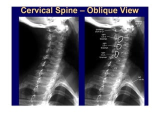 07/12/2015 Dr. José Heitor M. Fernandes 72
 