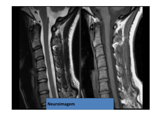 07/12/2015 Dr. José Heitor M. Fernandes 76Neuroimagem
 