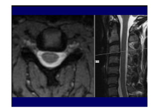 figura
figura
07/12/2015 Dr. José Heitor M. Fernandes 78
 
