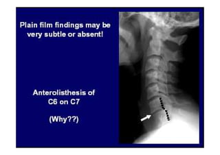 figura
07/12/2015 Dr. José Heitor M. Fernandes 80
 