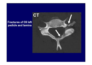 07/12/2015 Dr. José Heitor M. Fernandes 81
 