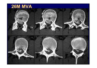 figura
07/12/2015 Dr. José Heitor M. Fernandes 83
 