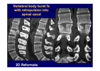 figura
07/12/2015 Dr. José Heitor M. Fernandes 84
 