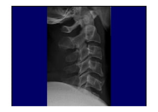 figura
07/12/2015 Dr. José Heitor M. Fernandes 85
 