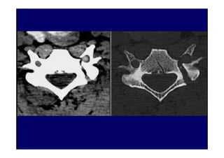 figura
07/12/2015 Dr. José Heitor M. Fernandes 86
 