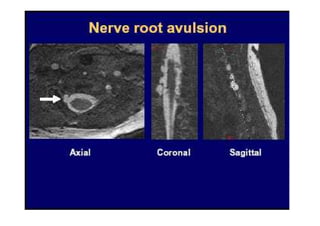 figura
07/12/2015 Dr. José Heitor M. Fernandes 89
 