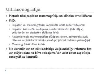 Ultrasonogrāfija
 Metode tikai papildina mammogrāfiju un klīnisko izmeklēšanu;
 IND:
 Palpatori vai mammogrāfiski konstatēts krūts audu veidojums;
 Palpatori konstatēts veidojums jaunām sievietēm (līdz 30g.v.),
grūtniecēm un sievietēm zīdīšanas laikā;
 Neapmierinošs mammogrāfijas slēdziens (piem., asimetrisks audu
blīvums, nepietiekami vai tikai vienā projekcijā redzama patoloģija);
 Mammogrāfiski blīvas krūtis.
 Ne vienmēr var noteikt labdabīgu vai ļaundabīgu raksturu, bet
var atšķirt cistu no blīva veidojuma.Var veikt cistas aspirāciju
sonogrāfijas kontrolē.
 
