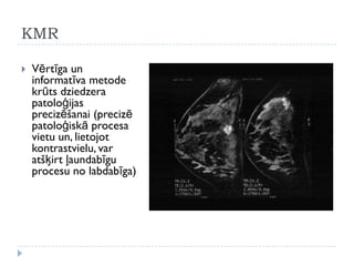 KMR
 Vērtīga un
informatīva metode
krūts dziedzera
patoloģijas
precizēšanai (precizē
patoloģiskā procesa
vietu un, lietojot
kontrastvielu, var
atšķirt ļaundabīgu
procesu no labdabīga)
 