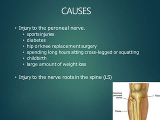CAUSES
• Injury to the peroneal nerve.
• sportsinjuries
• diabetes
• hip orknee replacement surgery
• spending long hours sitting cross-legged or squatting
• childbirth
• large amount of weight loss
• Injury to the nerve roots in the spine (L5)
 