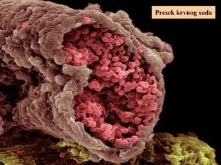 Presek krvnog suda
 