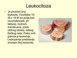 Leukocitoza
•

je povećan broj
leukocita. Fiziološka 1020 x 10 9/l se javlja kod
novorođenčadi, pri
laktaciji, trudnoći,
menstruaciji, posle
obilnog obroka, teškog
fizičkog rada. Preko ovih
granica je leukemija.
Leukopenija predstavlja
smanjen broj leukocita.

 