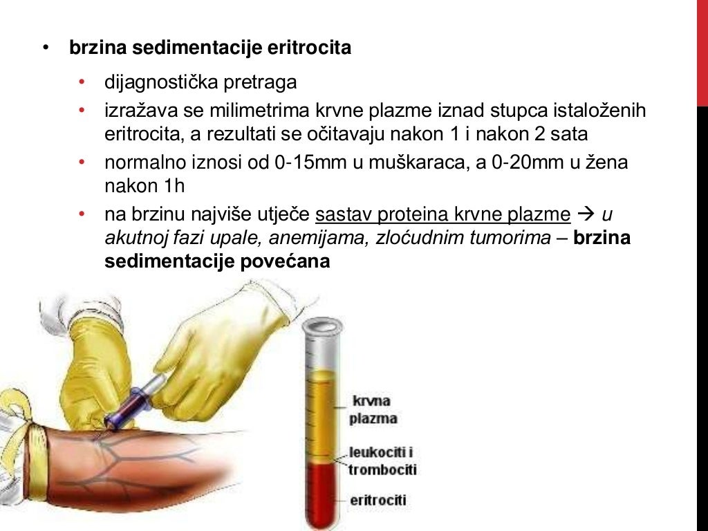 Krvni sustav