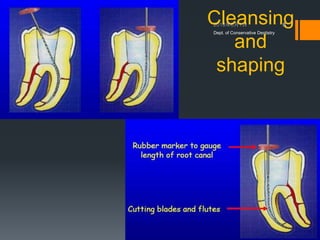 Access Cavity Prepration | PPTX