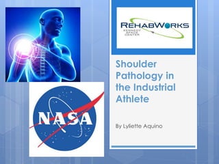 Shoulder 
Pathology in 
the Industrial 
Athlete 
By Lyliette Aquino 
 